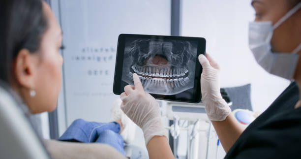 Licensed Tooth Extraction service in New Waverly, TX - Smile Center Dentistry